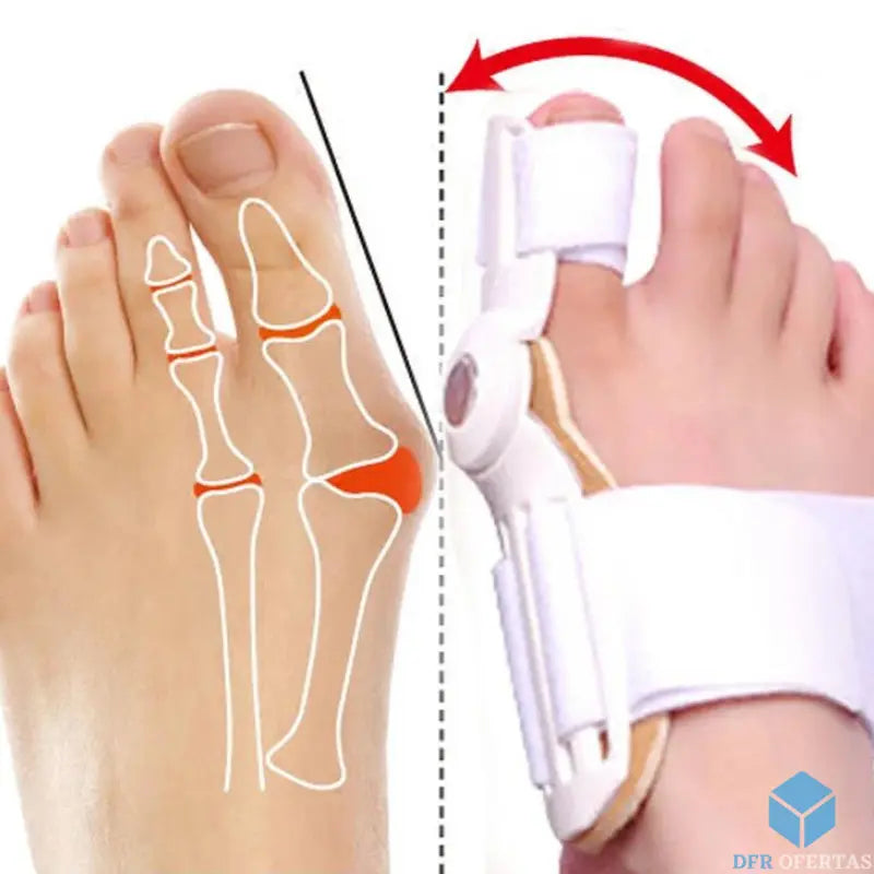 Corretor Ergonômico de Joanete - Reliefmax
