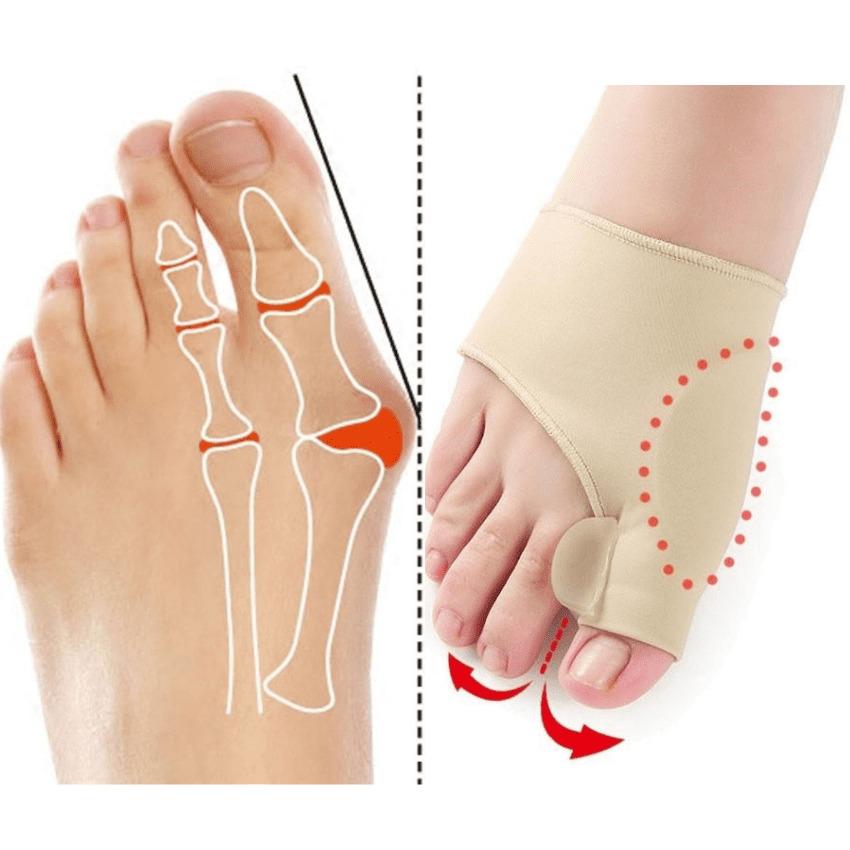 Corretor Ergonômico de Joanete - Correctionmax